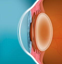 Recovery Time After Vision Correction Surgery: Compare Your Options